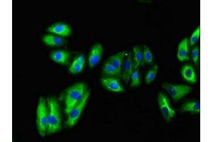 Immunofluorescent analysis of HepG2 cells using ABIN7162595 at dilution of 1:100 and Alexa Fluor 488-congugated AffiniPure Goat Anti-Rabbit IgG(H+L)
