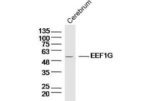 Lane 1:Mouse cerebellum lysates probed with EEF1G Polyclonal Antibody, Unconjugated  at 1:300 overnight at 4˚C. (EEF1G anticorps  (AA 251-350))
