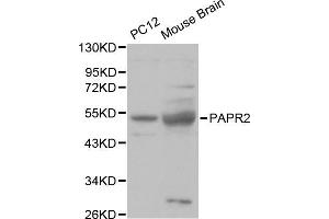 Western blot analysis of various cell lines, using PARK2 antibody.