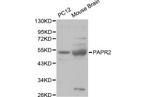 Western blot analysis of various cell lines, using PARK2 antibody. (Parkin anticorps  (AA 1-300))