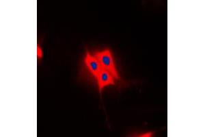 Immunofluorescent analysis of AS160 (pT642) staining in Raw264. (TBC1D4 anticorps  (pSer642))