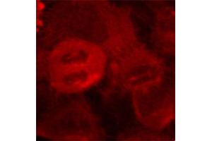 Immunofluorescence staining of methanol-fixed HeLa cells using Phospho-MAP2K2-T394 antibody (ABIN2987359). (MEK2 anticorps  (pThr394))