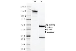 SDS-PAGE Analysis Purified Mesothelin Mouse Monoclonal Antibody (MSLN/2131). (Mesothelin anticorps  (AA 273-407))