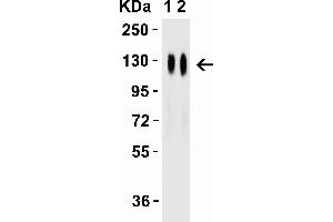 Western Blot Validation with SARS-CoV-2 (COVID-19) Spike Recombinant Protein Loading: 50 ng per lane of SARS-CoV-2 (COVID-19) Spike S1 recombinant protein (97-087). (SARS-CoV-2 Spike anticorps  (RBD))