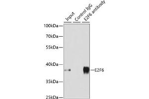 Immunoprecipitation analysis of 200 μg extracts of MCF-7 cells using 3 μg E2F6 antibody (ABIN1679632, ABIN1679631, ABIN5664137 and ABIN6219769). (E2F6 anticorps  (AA 1-281))