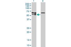 Western Blot analysis of ACVRL1 expression in transfected 293T cell line by ACVRL1 monoclonal antibody (M01), clone 5B1. (ACVRL1 anticorps  (AA 22-119))
