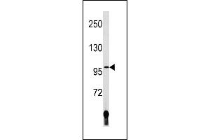 LIG4 Antibody (N-term) (ABIN1881497 and ABIN2843215) western blot analysis in human placenta tissue lysates (35 μg/lane). (LIG4 anticorps  (N-Term))