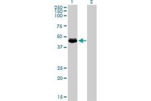 Western Blot analysis of TGFB1I1 expression in transfected 293T cell line by TGFB1I1 monoclonal antibody (M01), clone 4B2-D8.