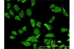 Immunofluorescence of monoclonal antibody to RPL36A on HeLa cell. (RPL36A anticorps  (AA 7-106))
