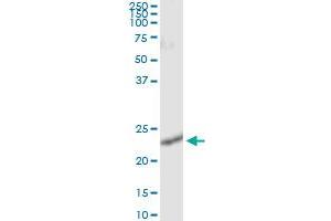 Immunoprecipitation of RALB transfected lysate using anti-RALB monoclonal antibody and Protein A Magnetic Bead , and immunoblotted with RALB MaxPab rabbit polyclonal antibody.