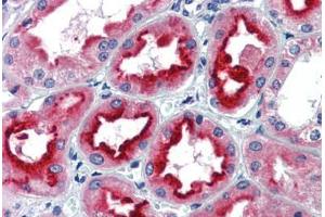 Human Kidney (formalin-fixed, paraffin-embedded) stained with SIN3A antibody ABIN462178 followed by biotinylated goat anti-rabbit IgG secondary antibody ABIN481713, alkaline phosphatase-streptavidin and chromogen.