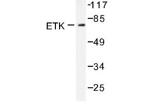 Image no. 1 for anti-BMX Non-Receptor Tyrosine Kinase (BMX) antibody (ABIN272022) (BMX anticorps)