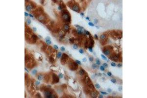 Immunohistochemical analysis of CPT2 staining in mouse kidney formalin fixed paraffin embedded tissue section. (CPT2 anticorps)