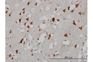 Image no. 3 for anti-Eukaryotic Translation Initiation Factor 2-alpha Kinase 2 (EIF2AK2) (AA 1-101) antibody (ABIN598900) (EIF2AK2 anticorps  (AA 1-101))