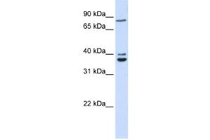 Western Blotting (WB) image for anti-Chromosome 18 Open Reading Frame 10 (C18orf10) antibody (ABIN2459872) (TPGS2 anticorps)