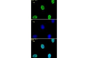 Histone H3K4me2 antibody (pAb) tested by immunofluorescence. (Histone 3 anticorps  (2meLys4))