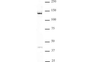 DDB1 antibody (pAb) tested by Western blot Nuclear extract of HeLa cells (30 μg) probed with DDB1 antibody (1:500). (DDB1 anticorps  (C-Term))