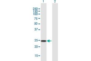 Western Blot analysis of SSX4 expression in transfected 293T cell line by SSX4 MaxPab polyclonal antibody. (SSX4 anticorps  (AA 1-188))