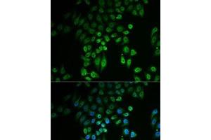 Immunofluorescence analysis of U2OS cells using GPLD1 Polyclonal Antibody (GPLD1 anticorps)