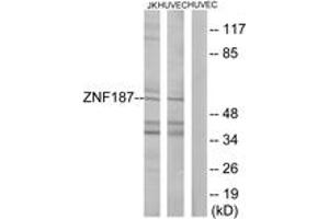 Western Blotting (WB) image for anti-Zinc Finger Protein 187 (ZNF187) (AA 51-100) antibody (ABIN2889623) (ZNF187 anticorps  (AA 51-100))