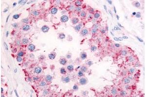 Human Testis (formalin-fixed, paraffin-embedded) stained with PDE11A antibody ABIN213553 at 5 ug/ml followed by biotinylated goat anti-rabbit IgG secondary antibody ABIN481713, alkaline phosphatase-streptavidin and chromogen.