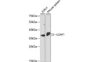 Western blot analysis of extracts of various cell lines, using U2 antibody (ABIN6130748, ABIN6149754, ABIN6214722 and ABIN6214724) at 1:1000 dilution.