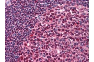 Immunohistochemical analysis of paraffin-embedded human Tonsil tissues using anti-Pirh2 mouse mAb