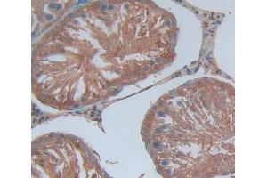 Figure. (ARHGEF7 anticorps  (AA 1-188))