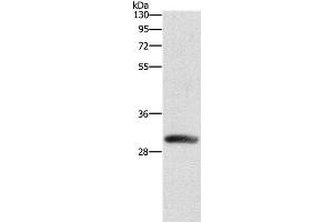 Western Blot analysis of Mouse heart tissue using DCK Polyclonal Antibody at dilution of 1:550 (DCK anticorps)