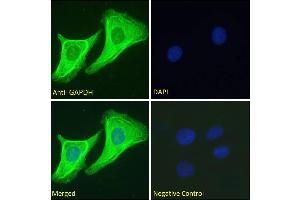 ABIN185240 Immunofluorescence analysis of paraformaldehyde fixed HeLa cells, permeabilized with 0. (GAPDH anticorps  (C-Term))