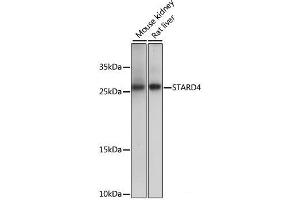 Western blot analysis of extracts of various cell lines using STARD4 Polyclonal Antibody at dilution of 1:1000. (STARD4 anticorps)