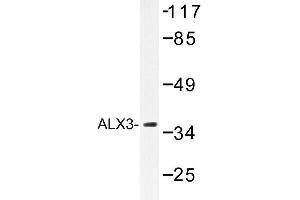 Image no. 1 for anti-ALX Homeobox 3 (ALX3) antibody (ABIN272147) (ALX3 anticorps)