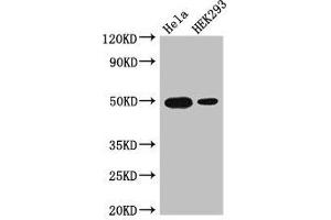 Western Blot Positive WB detected in: Hela whole cell lysate, HEK293 whole cell lysate All lanes: JUND antibody at 3 μg/mL Secondary Goat polyclonal to rabbit IgG at 1/50000 dilution Predicted band size: 36 kDa Observed band size: 50 kDa