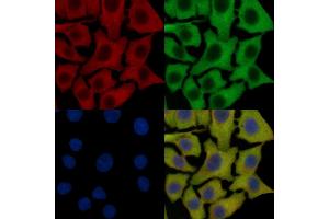 FGFR3 Mouse Monoclonal Antibody staining HepG2 cells by IF/ICC. (FGFR3 anticorps  (C-Term))