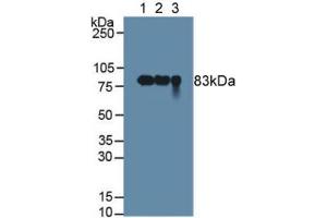 Figure. (PIGR anticorps  (AA 462-561))