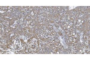 IHC analysis of CARD4/NOD1 using anti-CARD4/NOD1 antibody (ABIN7600975). (NOD1 anticorps  (AA 26-953))