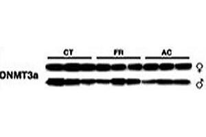 Dnmt3a antibody western blot with irradiated thymus tissue: CT=control mouse; FR=mouse subjected to fractionated exposure; AC=acutely exposed mouse. (DNMT3A anticorps  (AA 457-486))