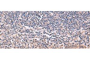 Immunohistochemistry of paraffin-embedded Human tonsil tissue using IFNA1:IFNA13 Polyclonal Antibody at dilution of 1:35(x200) (IFNA1 anticorps)