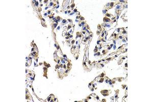 Immunohistochemistry (IHC) image for anti-C-Fos Induced Growth Factor (Vascular Endothelial Growth Factor D) (Figf) (AA 20-220) antibody (ABIN3021686)