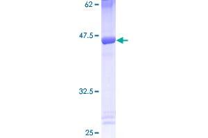 Image no. 1 for Eukaryotic Translation Initiation Factor 5A (EIF5A) (AA 1-154) protein (GST tag) (ABIN1352628)