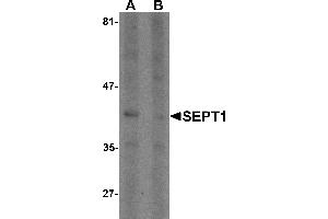 Western blot analysis of SEPT1 in Raji cell lysate with SEPT1 antibody at 1 µg/mL in (A) the absence and (B) the presence of blocking peptide. (Septin 1 anticorps  (C-Term))