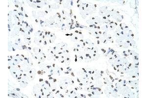 HNRPUL1 antibody was used for immunohistochemistry at a concentration of 4-8 ug/ml to stain Skeletal muscle cells (arrows) in Human Muscle.