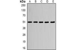 Western blot analysis of Alpha-tubulin 4a expression in HepG2 (A), MCF7 (B), mouse heart (C), mouse brain (D), PC12 (E) whole cell lysates.