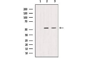 Western blot analysis of extracts from various samples, using TRIM44 antibody. (TRIM44 anticorps  (Internal Region))