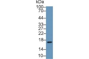 Detection of MYO in Rat Heart lysate using Polyclonal Antibody to Myoglobin (MYO)