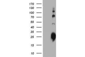 Western Blotting (WB) image for anti-Immunoglobulin J Polypeptide, Linker Protein For Immunoglobulin alpha and mu Polypeptides (IGJ) antibody (ABIN1498838) (IGJ anticorps)