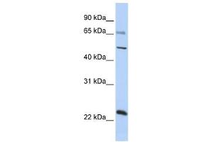 ZNF597 antibody used at 0. (ZNF597 anticorps  (Middle Region))