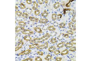 Immunohistochemistry of paraffin-embedded rat kidney using PIK3CA antibody. (PIK3CA anticorps)