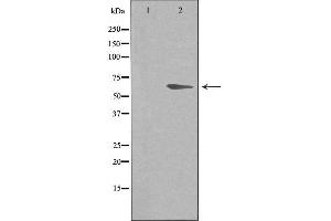 Western blot analysis of extracts from HeLa cells, using ADRB2 antibody. (beta 2 Adrenergic Receptor anticorps  (C-Term))