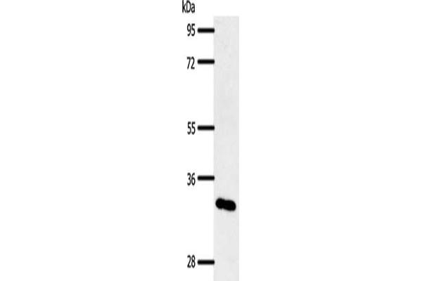 SLC2A4RG anticorps